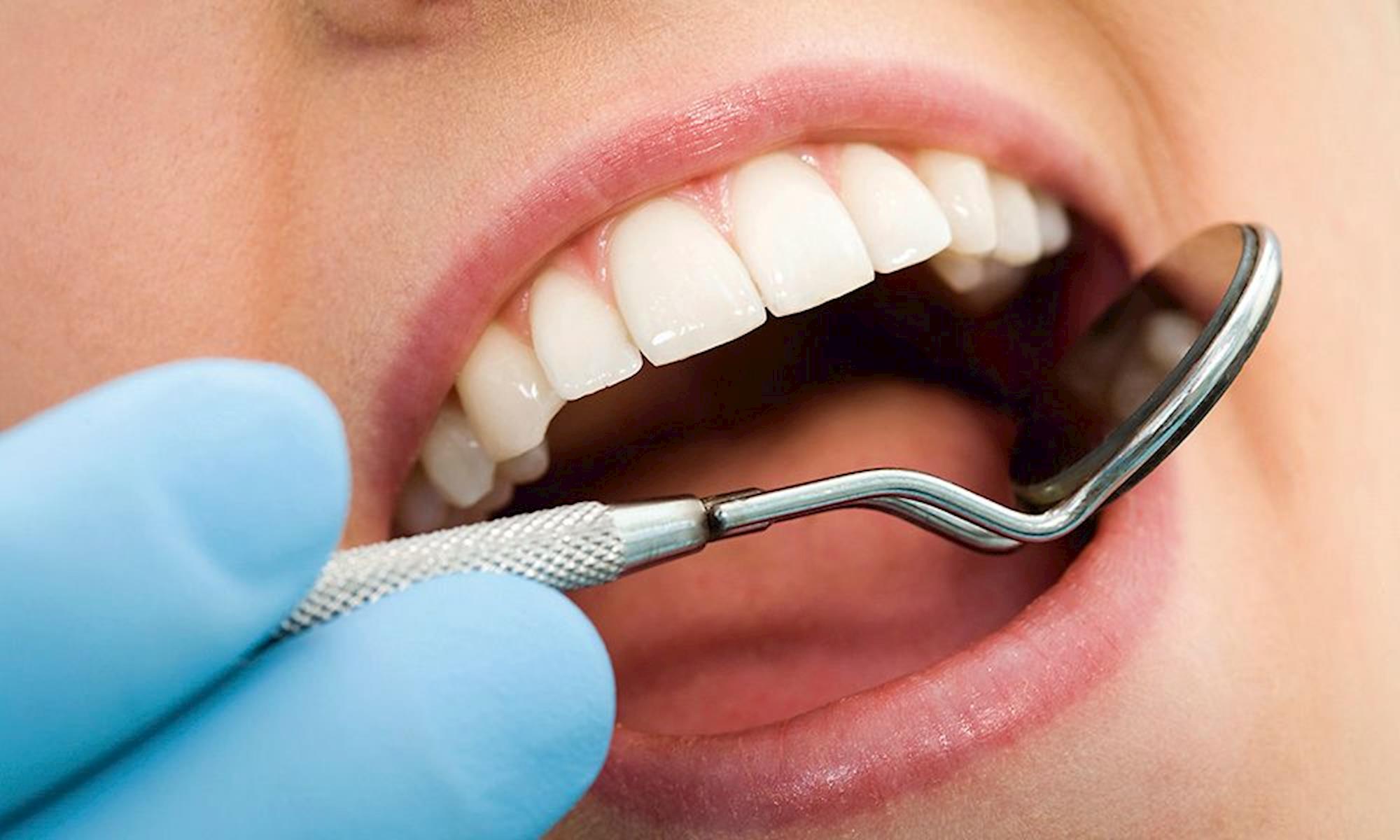 Quando devo ir ao dentista?